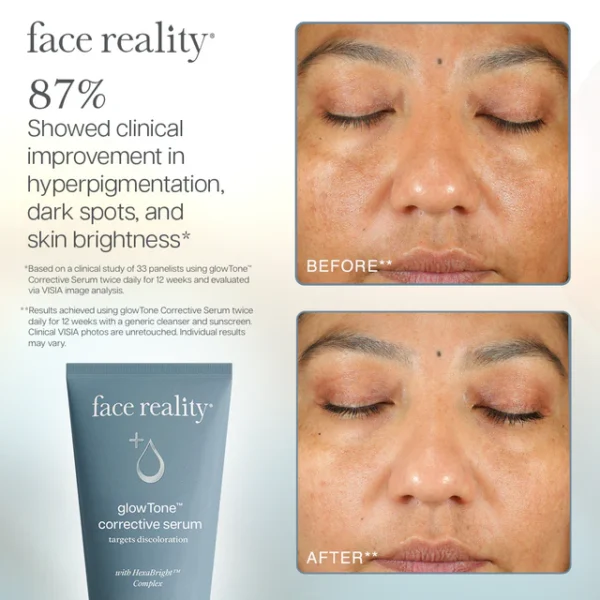 glowTone™ Corrective Serum - Image 12